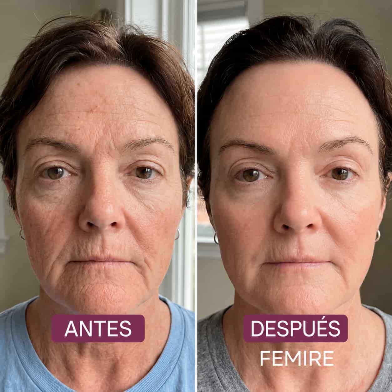 FEMIRE – Mascarilla nocturna de colágeno