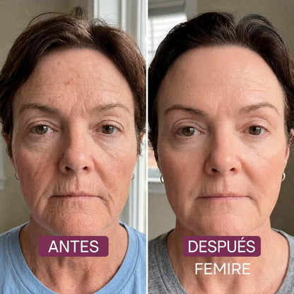 FEMIRE – Mascarilla nocturna de colágeno